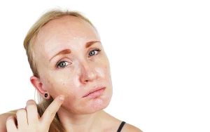 How to Manage Oily Skin: Tips and Tricks