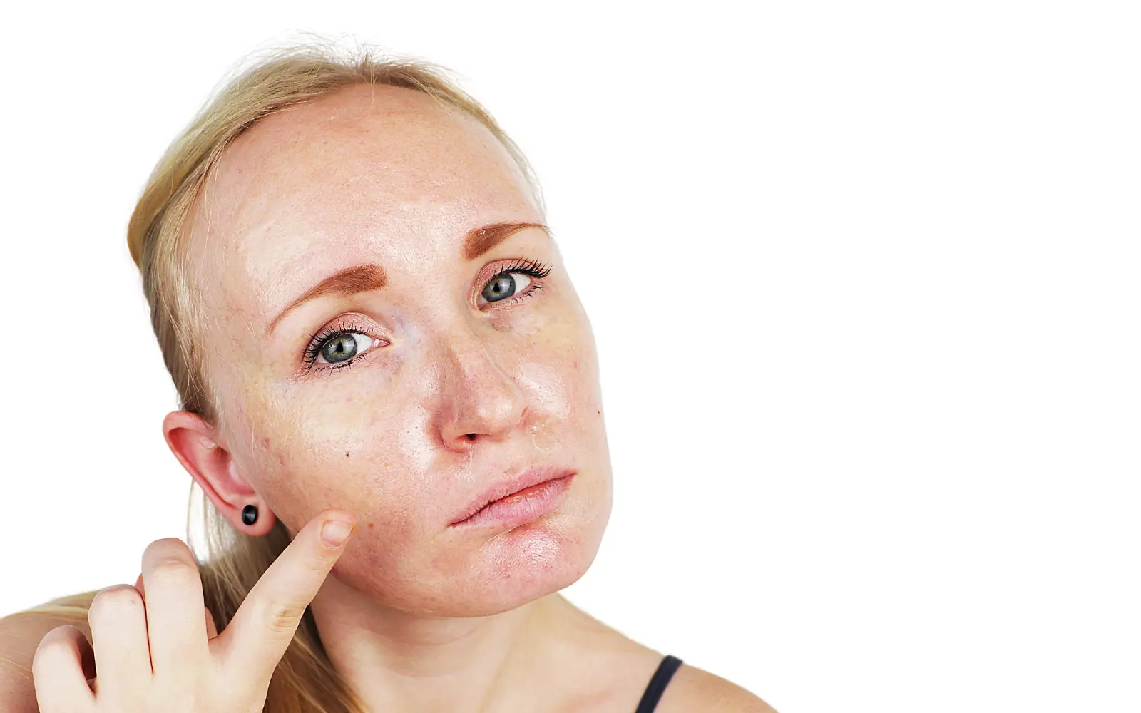 How to Manage Oily Skin: Tips and Tricks